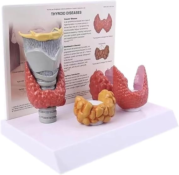 Thyroid Anatomy Model, Display Study Human Body Anatomical Model Teaching Tool Thyroid Nodule Model, 3:1 Showing The Thyroid Pathological Digestive System
