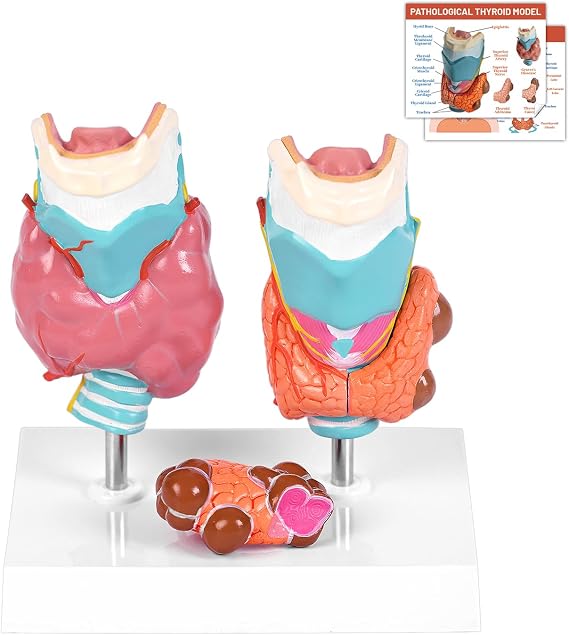 JNMFTD Human Thyroid Pathology Anatomy Model, Life Size 4 Parts Thyroid Anatomical Detachable Goiter Thyroid Disease with Manual Card Removable PVC Base for Medical Study Education Physiology