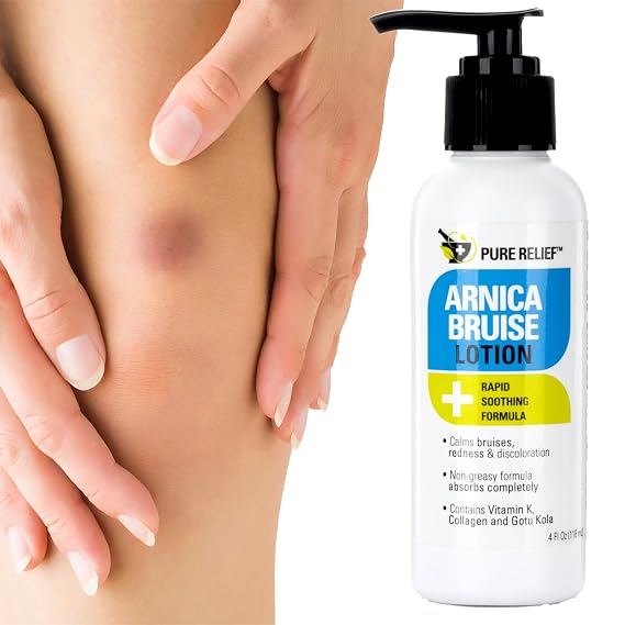 Pure Relief Arnica Cream Bruise Relief Lotion for Bruising and Swelling on Skin, Extra Strength Vitamin K, Moisturizing Formula Skin Care With Collagen, 4 Fl Oz